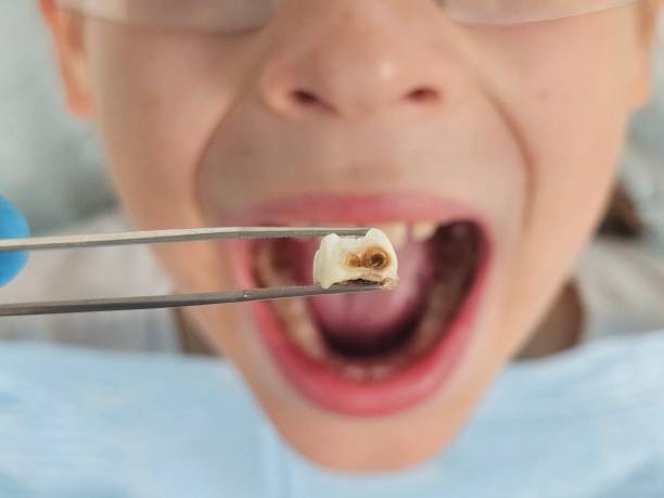 Best After-Hours Emergency Dentist in Lone Oak, TN